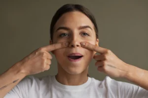 Rhinoplasty Mission Viejo