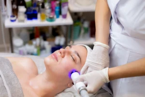 Laser Treatments for Acne and Sun Damage