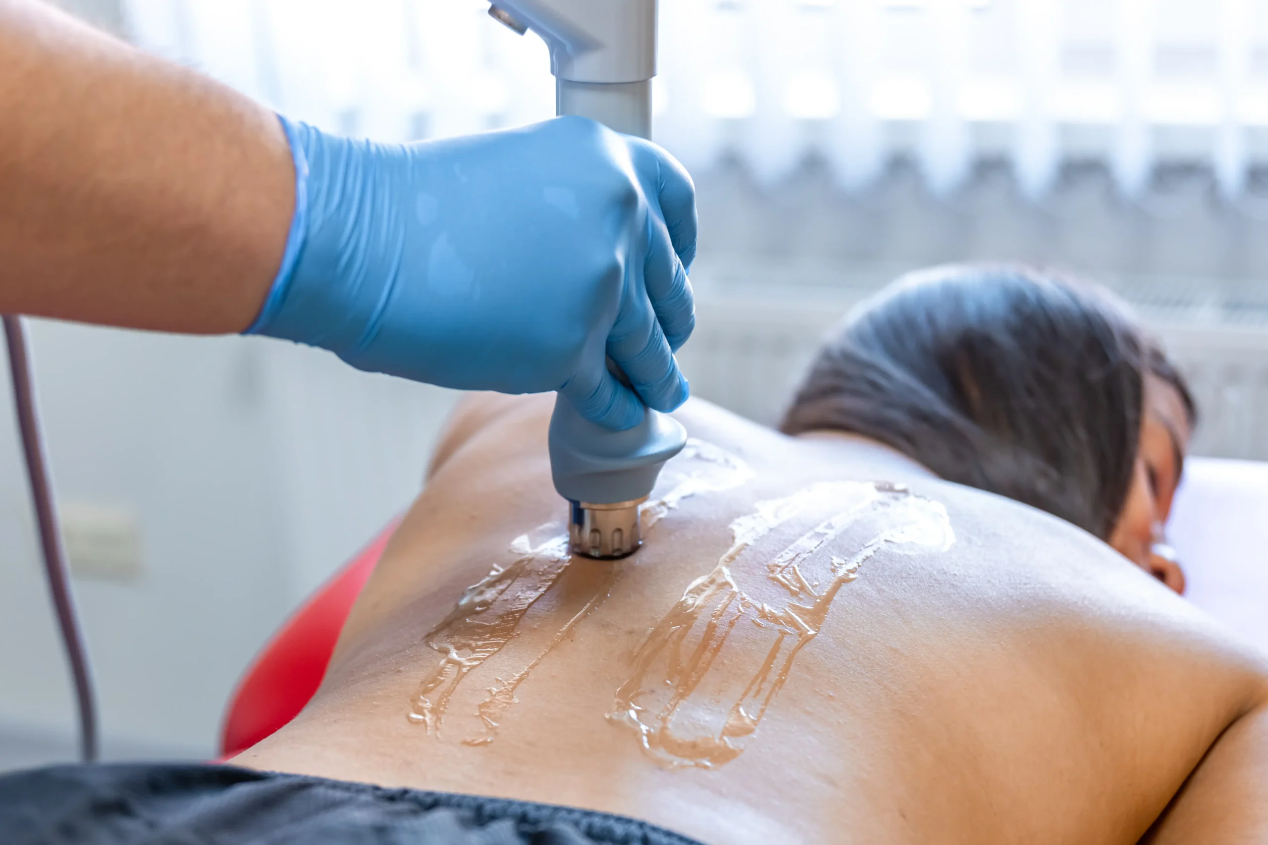 Dermasculpt Treatment – Robinson Facial Plastic Surgery