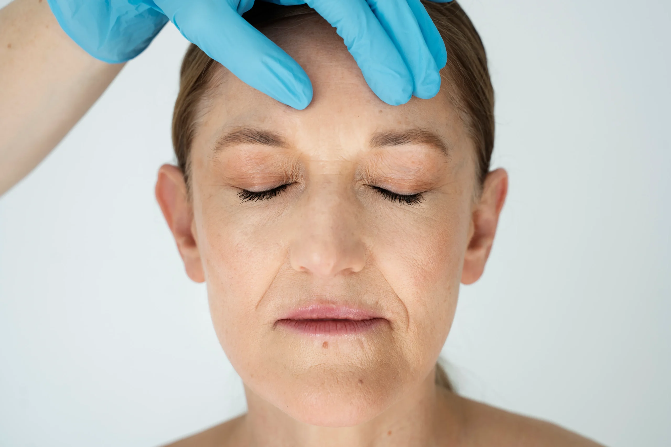 Botox for Migraine Headaches – Robinson Facial Plastic Surgery