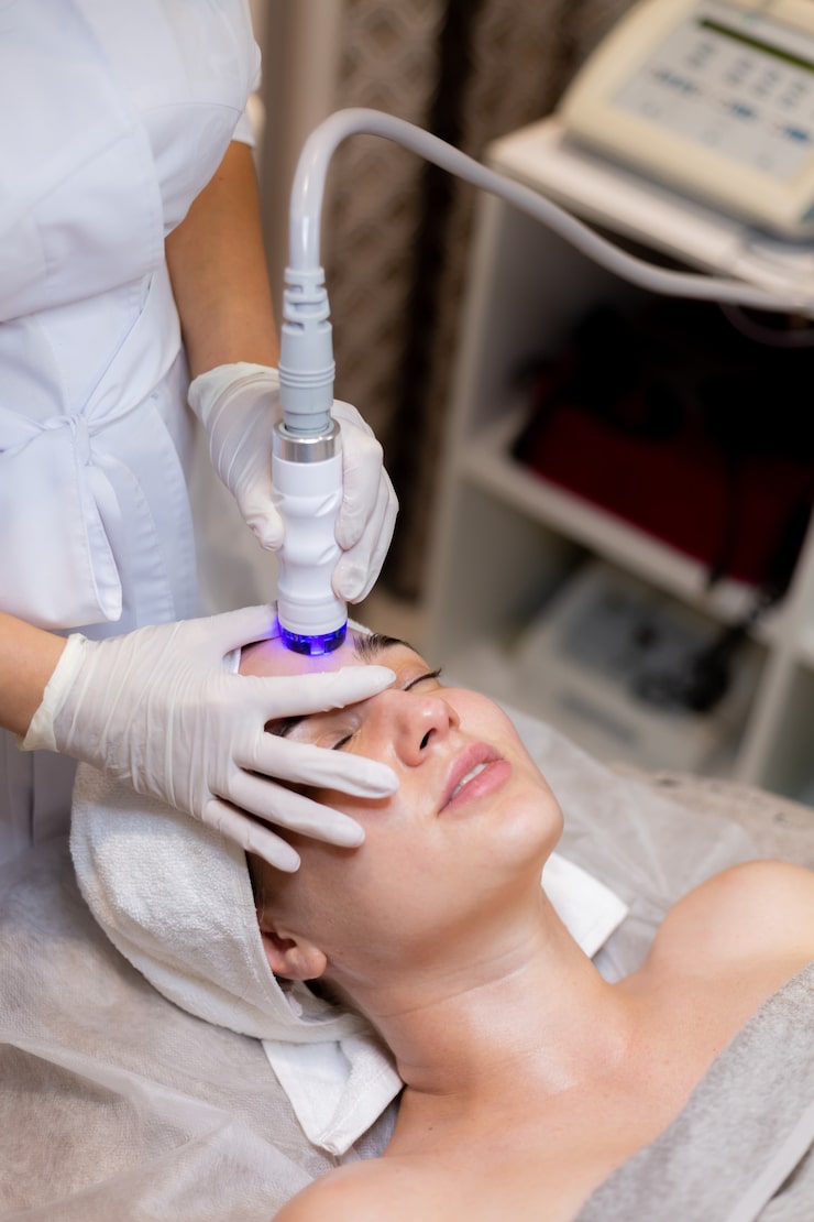 IPL Photofacial – Robinson Facial Plastic Surgery
