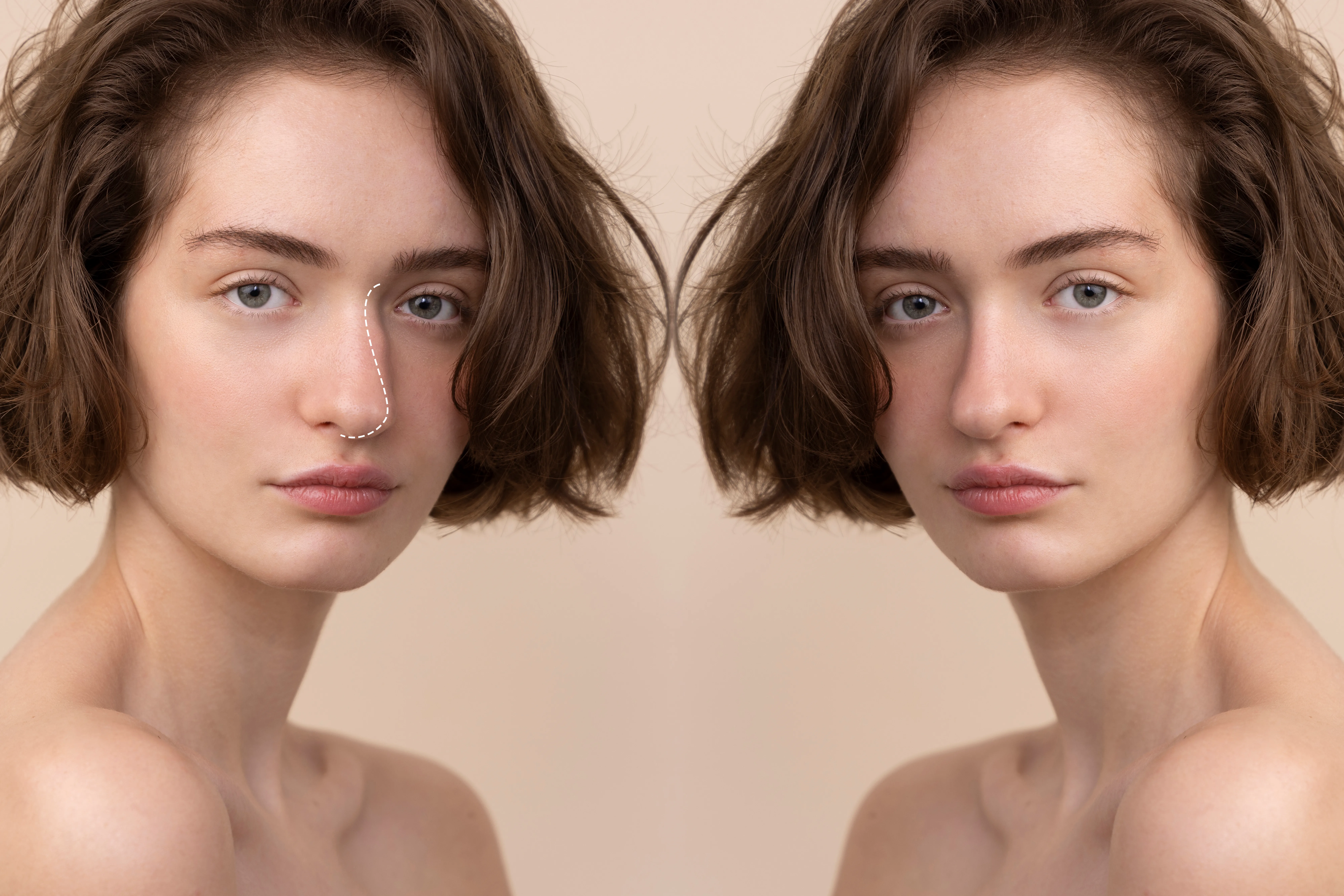 How Facial Proportions Influence Beauty and Rejuvenation