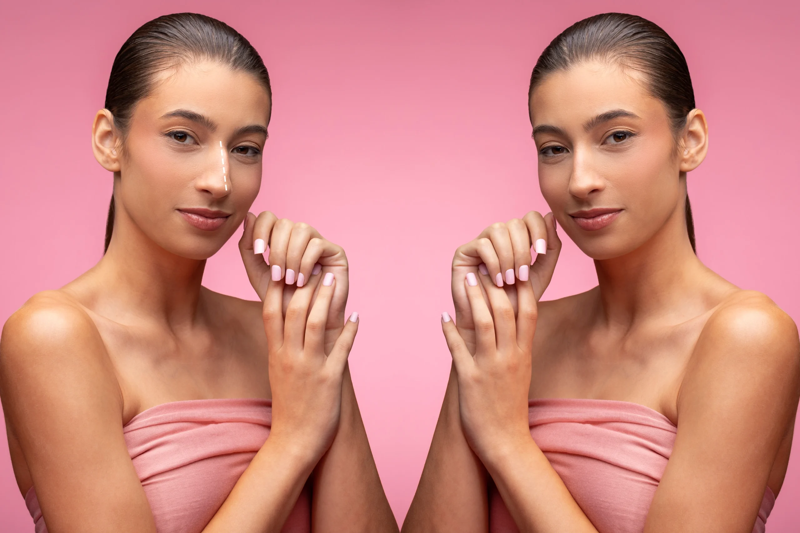 Dermal Filler Guide: Juvederm vs. Restylane vs. RHA